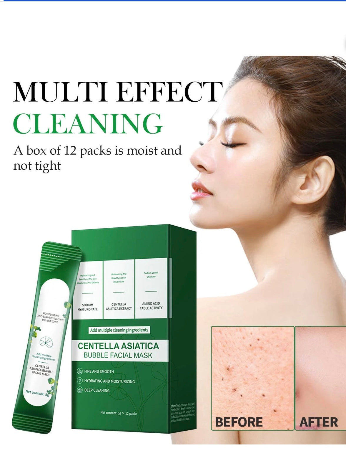 VENROCK Centella Asiatica Bubble Facial Mask | Deep Clean & Glow